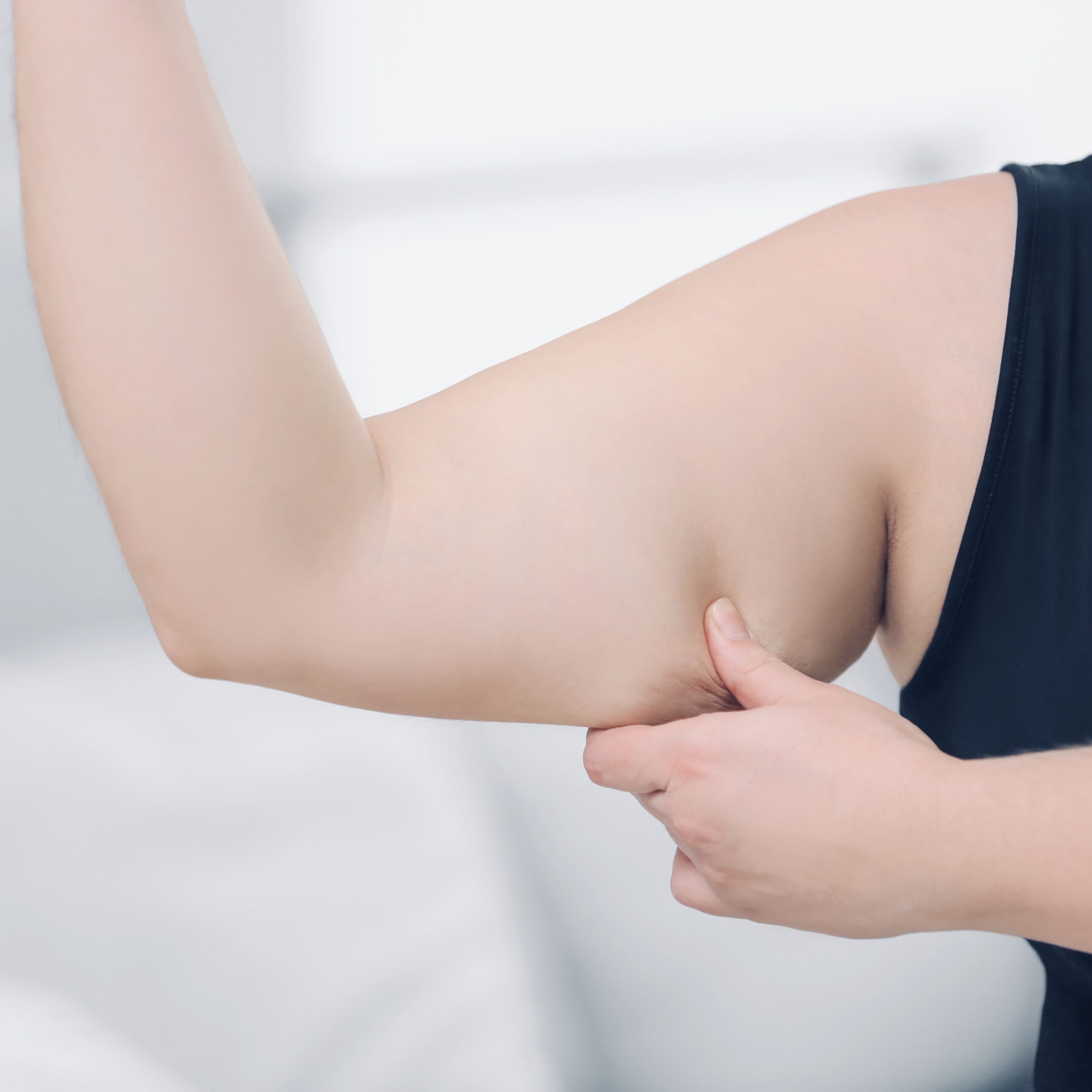 Treat Saggy Arms with Non-Surgical Skin Tightening