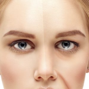 treat signs of aging in the mid-face