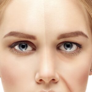 treat signs of aging in the mid-face