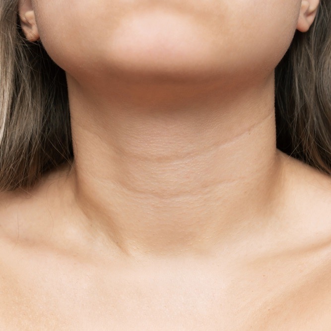 Say Goodbye to Neck Wrinkles at Cerulean Medical Institute in Kelowna BC